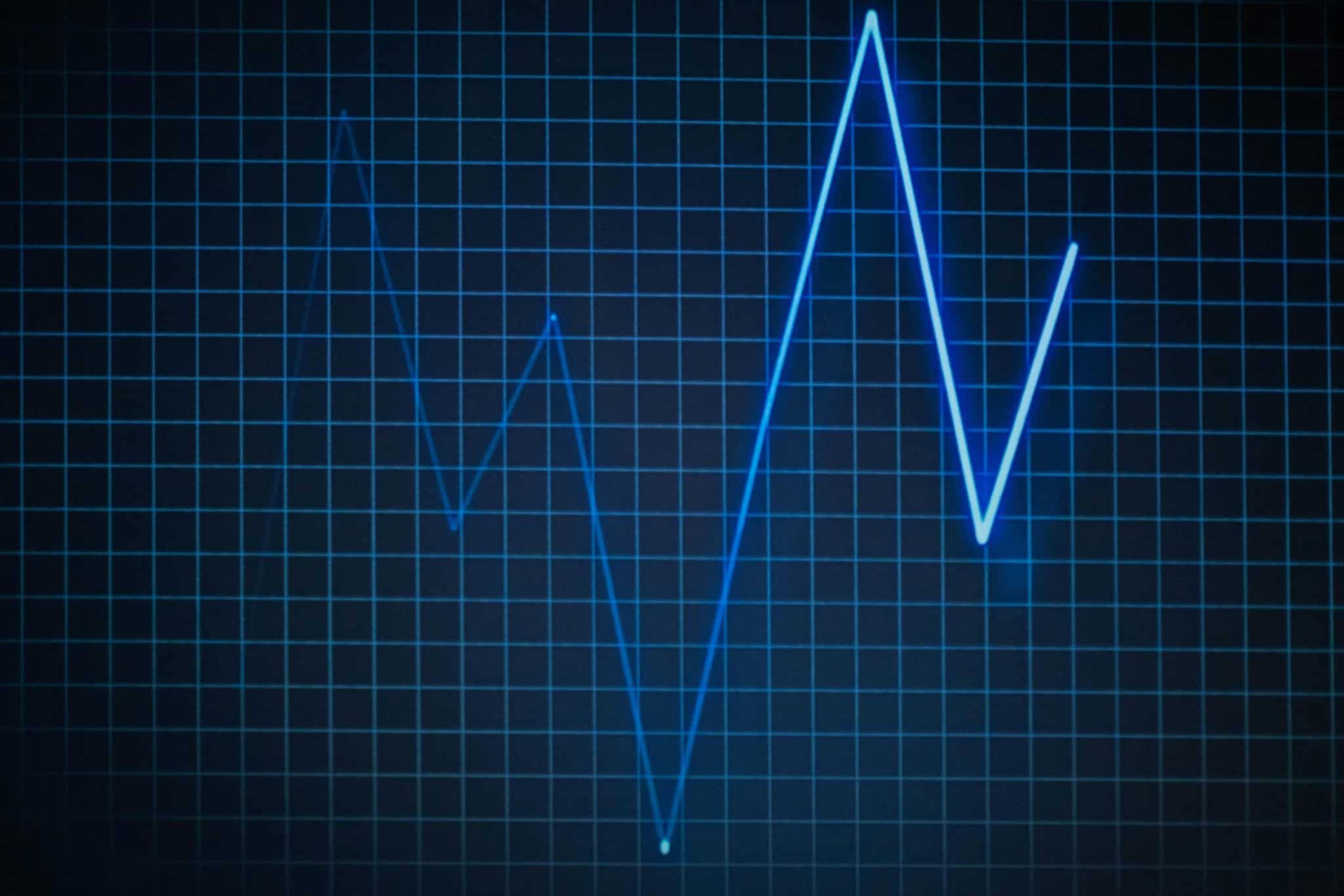 Wearable Technology: Monitoring Health in Real-Time